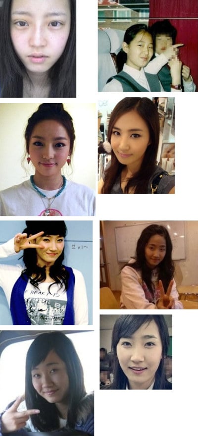 gyuri plastic surgery bigking keywords and pictures