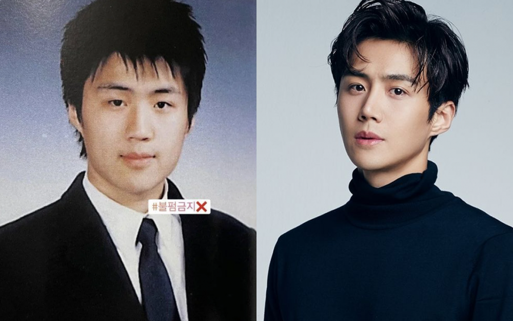Kim seon shop ho plastic surgery