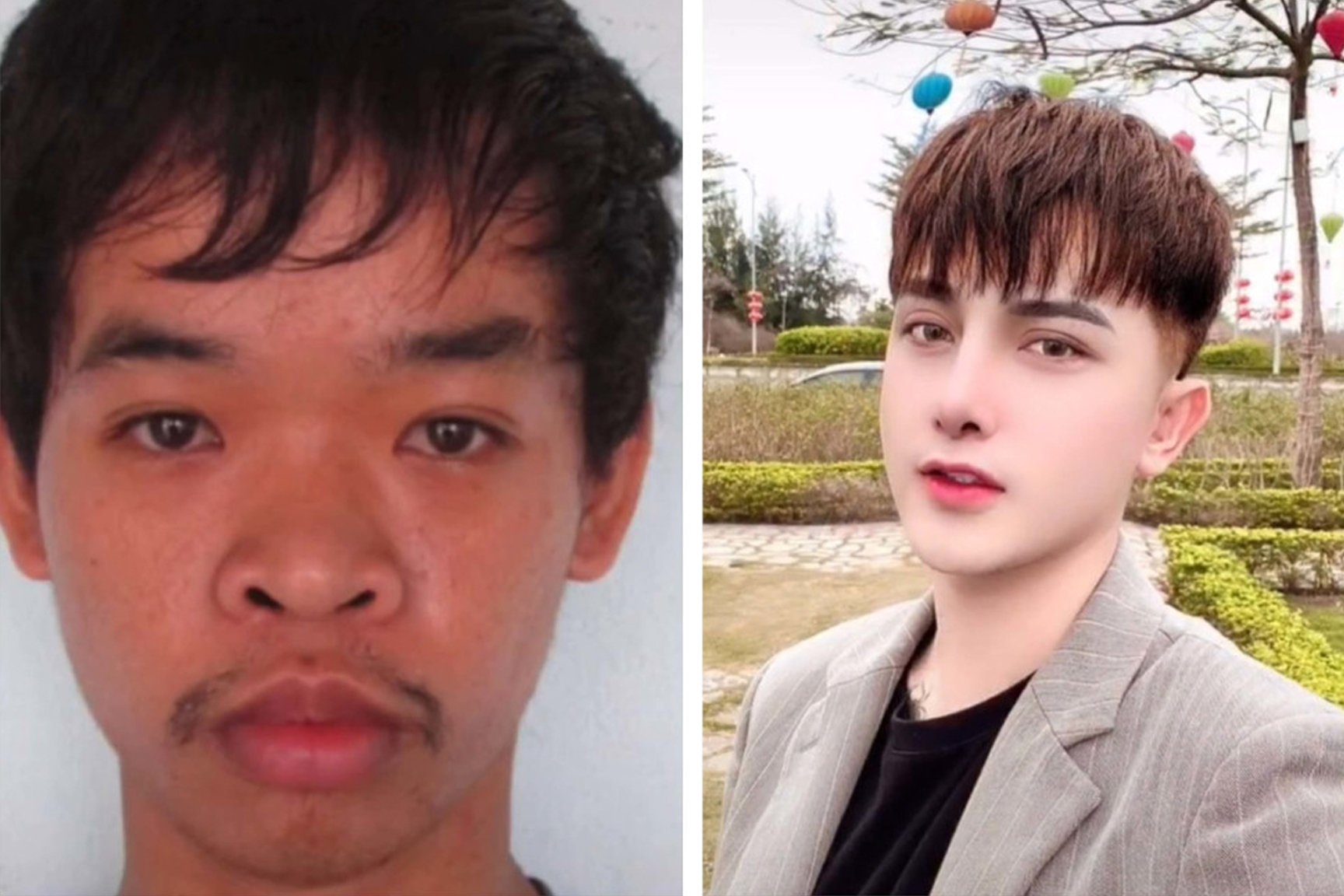 Vietnamese man gets numerous plastic surgeries to look like a K. www.allkpo...
