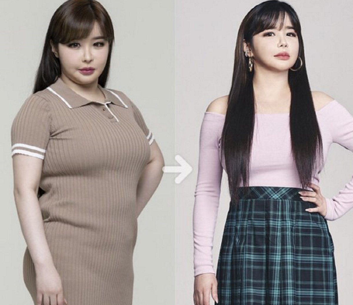 Bom's before and after photos become hot topic | allkpop