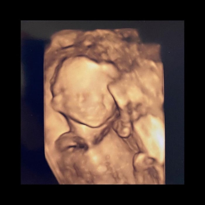 Гымми (ex-Crayon Pop) беременна вторым ребёнком