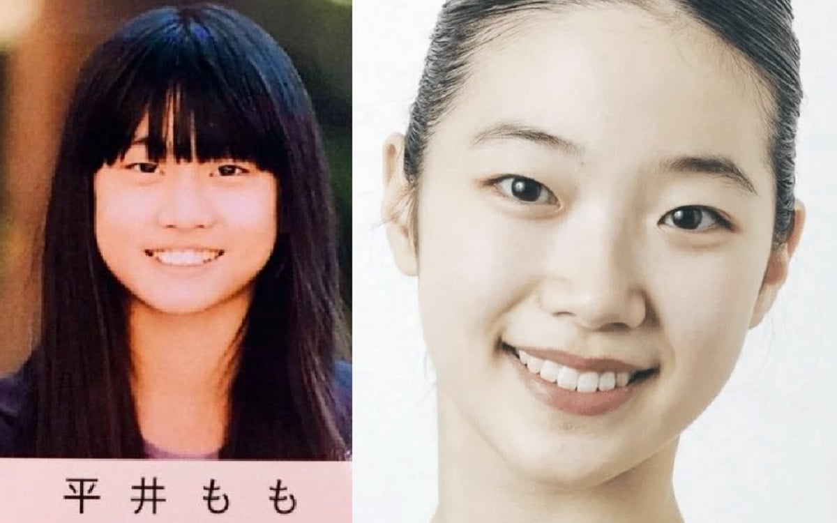 Kpop outlet eyelid surgery