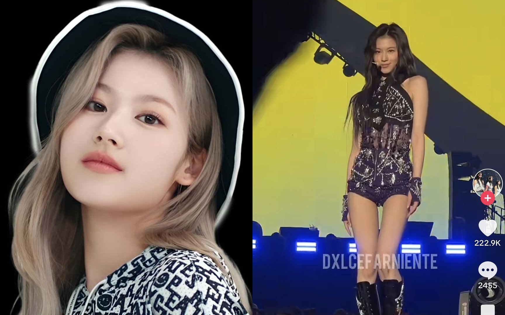Growing Worries over TWICE Sana's Shrinking Frame allkpop