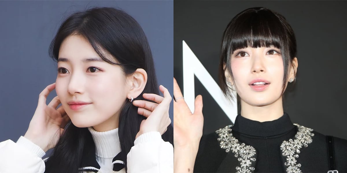 Suzy menghilangkan bintik hitam di dekat iris melalui prosedur kosmetik mata