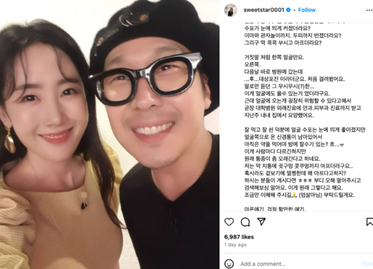 Istri Haha, Byul, mengumumkan istirahat sementara karena masalah kesehatan Istri Haha, Byul, mengumumkan istirahat sementara karena masalah kesehatan