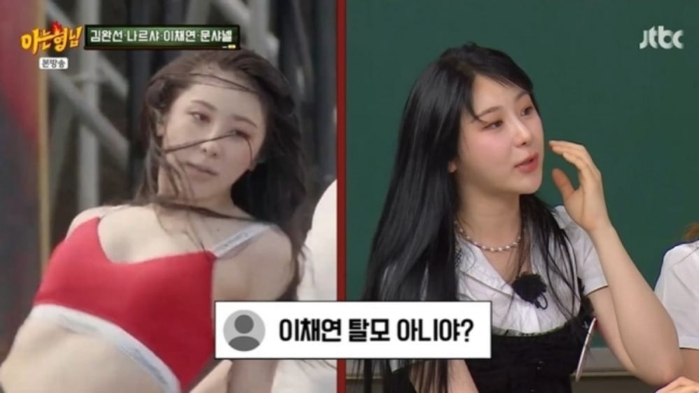 Lee Chae Yeon Ungkap Operasi Transplantasi Rambut di Knowing Bros