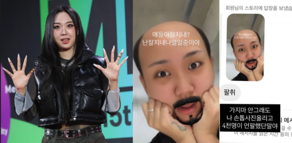 Lee Young Ji Kehilangan 4.000 Followers Usai Unggah Foto Kuku Terluka